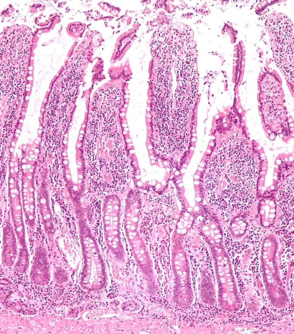 Photo: Nephron @ Wikimedia Commons