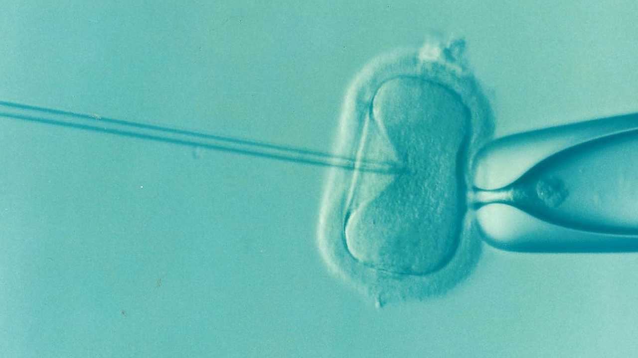 Photo: DrKontogianniIVF @ Wikimedia Commons