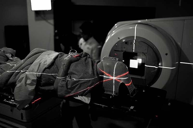radiotherapy