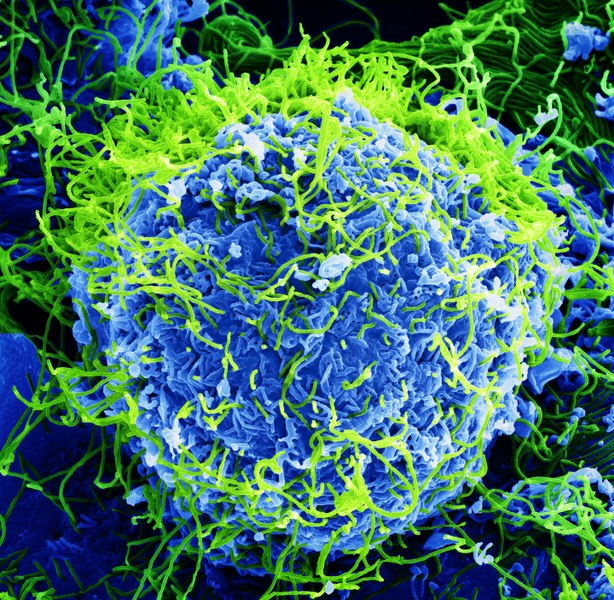 Ebola virus