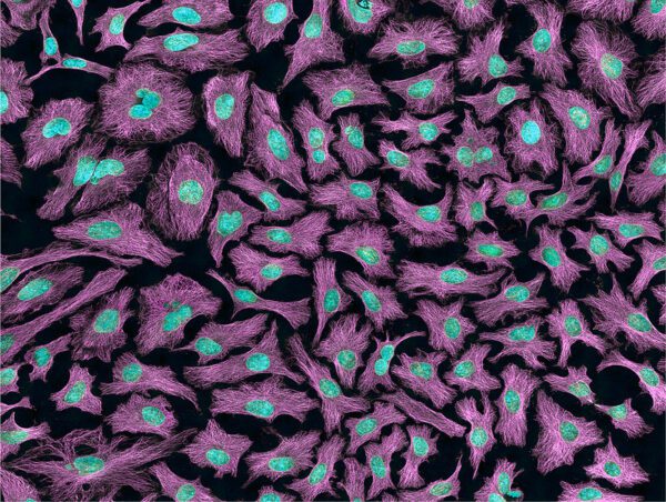 HeLa Cells [NIH image gallery @ Flickr]
