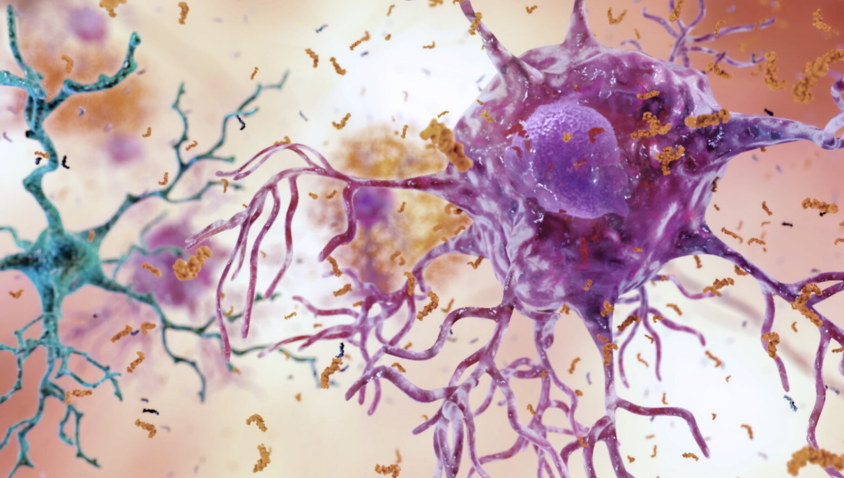 alzheimers, disease, neuron, memory