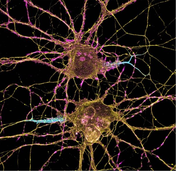 Photo: NIH Image Gallery @ Flickr