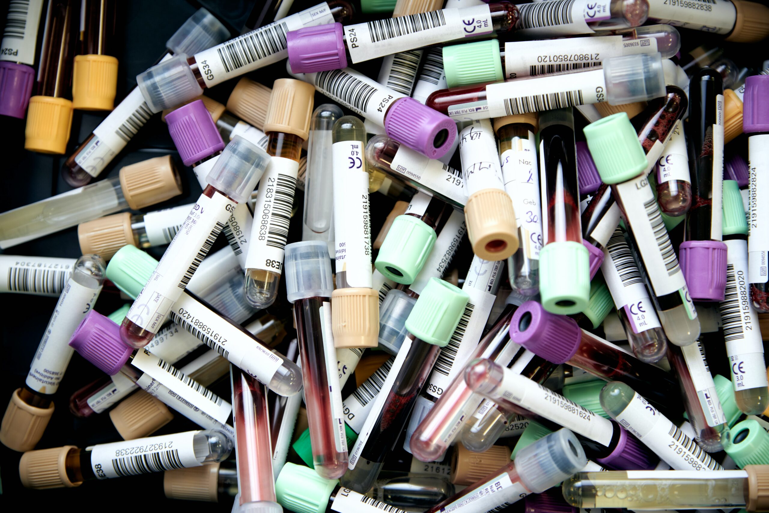 Vials, like those used in Alzheimer's blood testing, in a large pile.