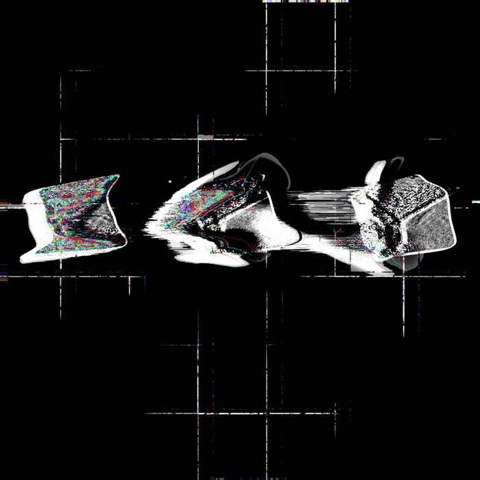 The Foyer Project, 'In: Static' Official Album Art