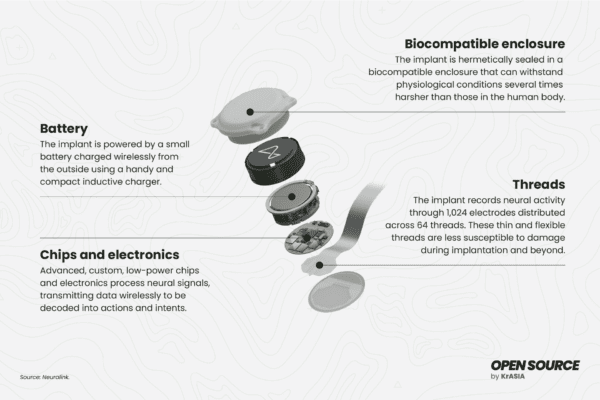 The components of Neuralinks