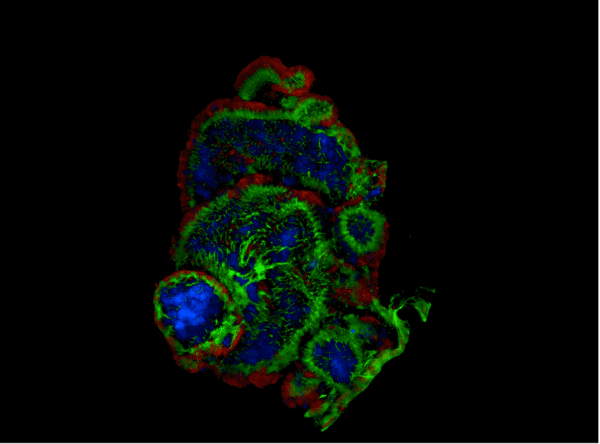 Immunofluorescence image of intestinal organoids generated using small intestine from mice which carry an Apc mutation, leading to spontaneous development of intestinal tumours.