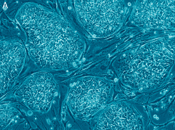 Human_embryonic_stem_cells_only_A-600x447