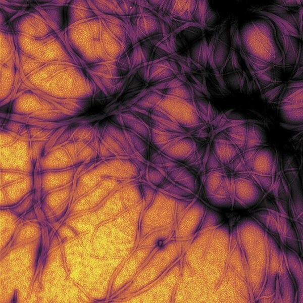 prion tendrils