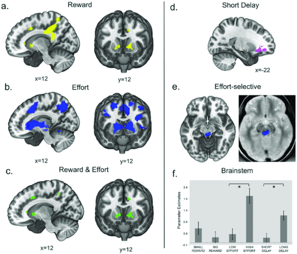 fMRI-Results-a-Reward-contrast-big-rewardsmall-reward-Activation-clusters-are